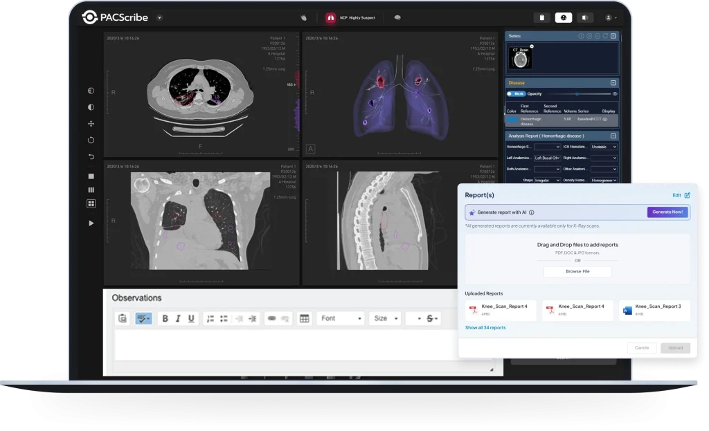 Single PACS Imaging Software for Every Step of the Workflow